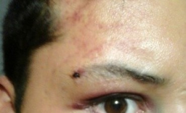 Emiliano y Agustin reciben una golpiza por un patovica y un encargado de seguridad”.
