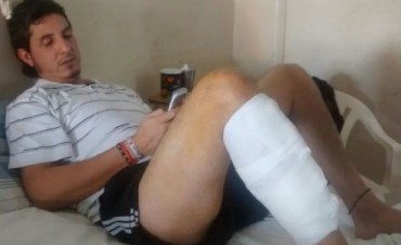 Olvidaron un guante dentro de su pierna y casi se la cortan
