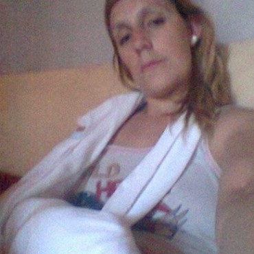 Màs que un susto y quebradura: Podrìa haber tenido mayores consecuencias
