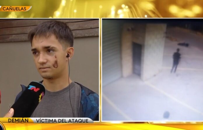 Otra brutal golpiza a un joven a la salida de un boliche, ahora en Cañuelas