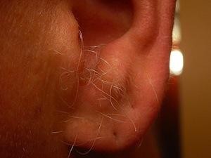 ¿Por qué a los hombres les salen pelos en las orejas?